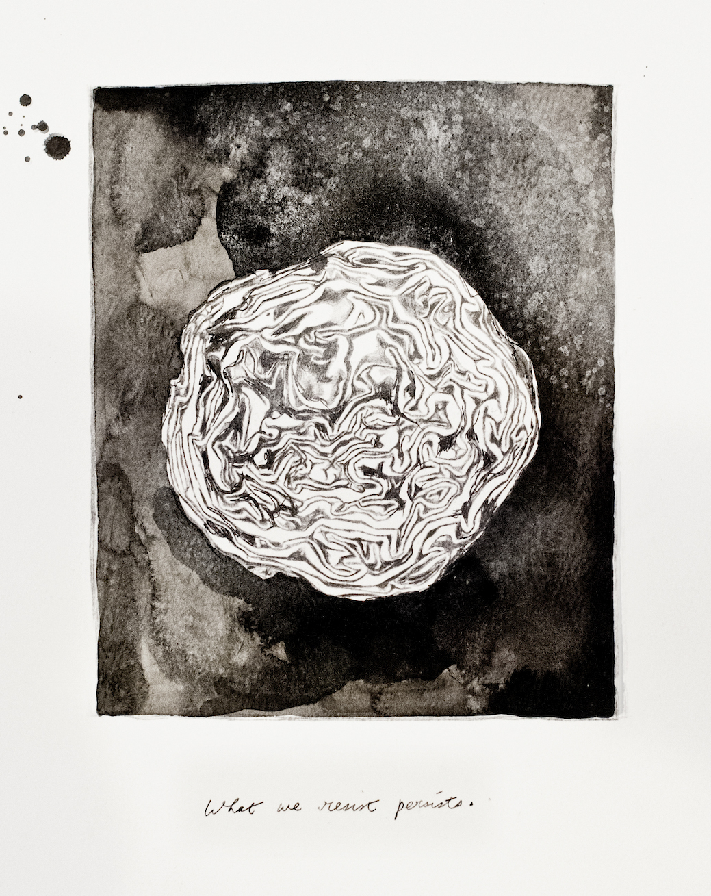 Migraine II