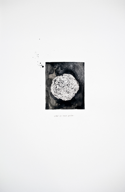 Migraine II